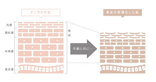 へたり肌
